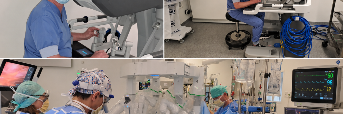 First robotic MIDCAB with the DaVinci Xi