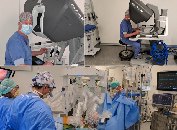 First robotic MIDCAB with the DaVinci Xi