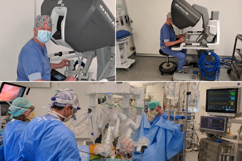 First robotic MIDCAB with the DaVinci Xi